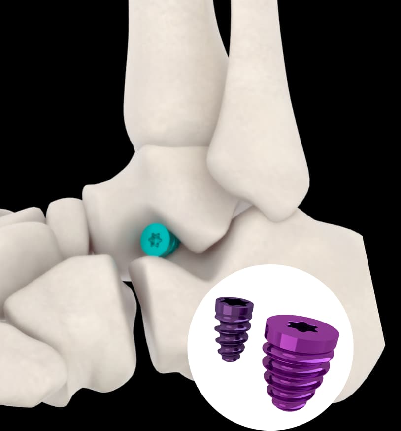 EXPERT KNOTLESS - FIXADOR DE ARTICULAÇÃO